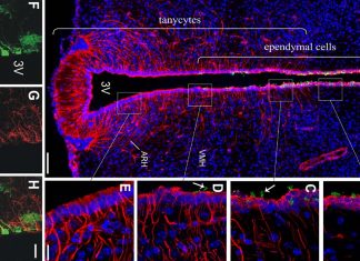 Appetite can be increased by tanycytes cells that respond to nutrients that signal the effect of feeling full