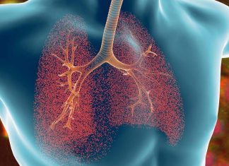 Researchers are studying the treatment of cystic fibrosis with TMEM16A inhibitors