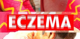 Eczema: i lipidi della pelle sono una protezione importante