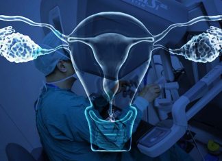 A study confirms that minimally invasive surgery for early-stage cervical cancer is linked to higher rates of recurrence and death