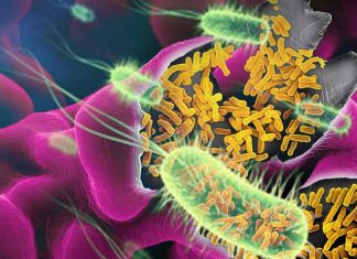 Clostridium difficile infection (CDI) can be treated with an innovative system that transplants intestinal bacteria