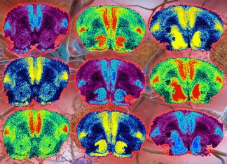 Alzheimer’s diseas : Oxytocin can reverse Aβ-induced impairments