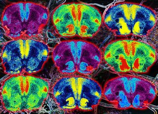Alzheimer: l’ossitocina può invertire le menomazioni indotte dalla Aβ