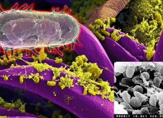 Bayannur – China : high alert after a suspected case of Bubonic Plague