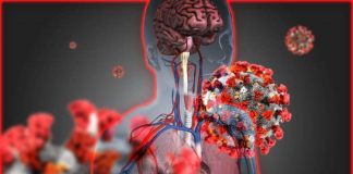 Physicians need to think of COVID-19 as a multisystem disease
