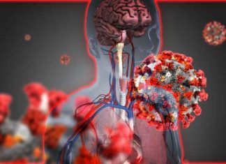 Physicians need to think of COVID-19 as a multisystem disease