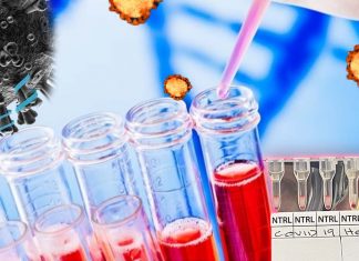 The world’s first COVID-19 blood test that detects positive people in 20 minutes