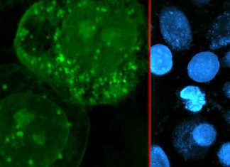 Fatty acid called DGLA can kill human cancer cells
