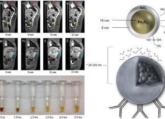 Risonanza magnetica di alta qualità a basso costo: nanoparticelle di ossido di ferro superparamagnetico (SPION) come agente di contrasto con risonanza magnetica a basso campo