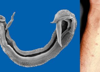 Widespread use of pesticides and other agrochemicals can speed the transmission of the debilitating disease schistosomiasis