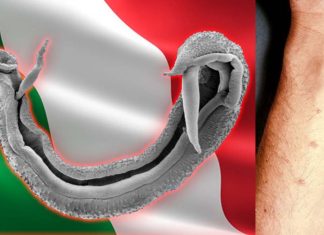L’uso diffuso di pesticidi e altri prodotti agrochimici può accelerare la trasmissione della schistosomiasi