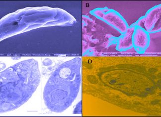 Toxoplasma gondii: More than 30 million Americans are infected with a brain parasite