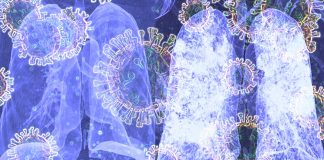 Chloroquine does not inhibit infection of human lung cells with COVID-19