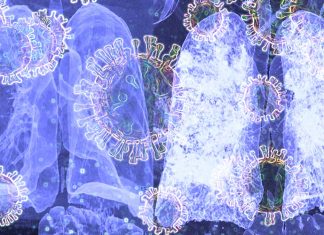 Chloroquine does not inhibit infection of human lung cells with COVID-19