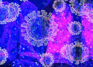 La clorochina non inibisce l’infezione delle cellule polmonari umane con COVID-19