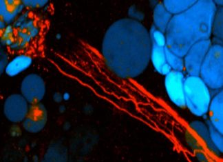 Leptin can regulate the presence of neurons in fat boosting calorie-burning capacity
