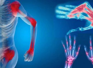 PRIME cells could reveal when rheumatoid arthritis will strike