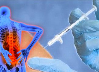 Sterile water injections provide effective pain relief for women with labor back pain