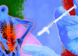 Le iniezioni di acqua sterile forniscono un efficace sollievo dal dolore per le donne con mal di schiena
