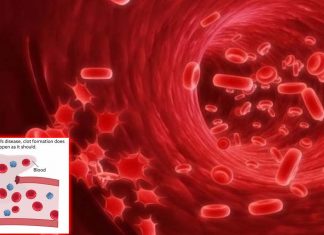 Severe course of COVID-19 may be associated with the von Willebrand factor