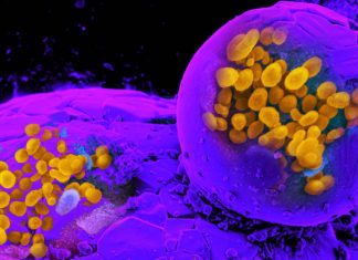 Aerosolized fomites: COVID-19 – Influenza viruses can spread through the air on dust