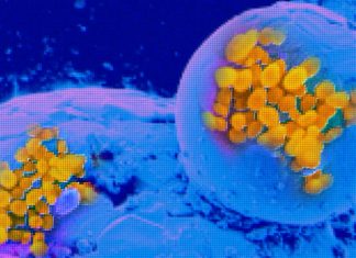 Fomiti aerosolizzati: COVID-19 e virus influenzali possono diffondersi nell’aria sulla polvere