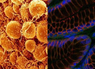 Beta2-adrenergic receptors (b2-AR) in brown fat cells are responsible for stimulating thermogenesis