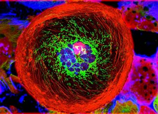 L’HDAC6 modificato geneticamente controlla la crescita del tumore e blocca le metastasi nel carcinoma mammario triplo negativo in vivo
