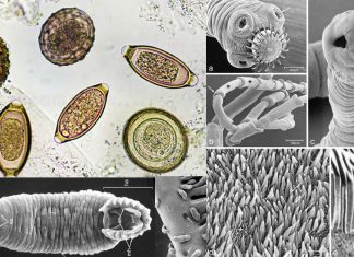 Helminth infections were common in medieval Europe and now infect around 1.5 billion people worldwide
