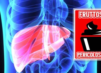 Un consumo eccessivo di fruttosio può provocare steatosi epatica non alcolica (NAFLD)
