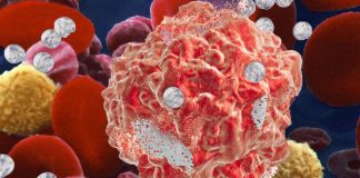 Removing copper from the blood can destroy some of the deadliest cancers