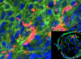 SARS-CoV-2 can infect human neural progenitor cells and brain organoid