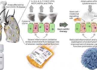 COVID-19: A new triple strategy could be effective for treating serious complications of pneumonia