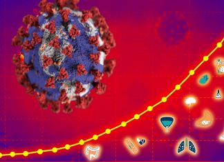 La presenza di multimorbidità e polifarmacia è associata a un rischio maggiore del 77% di un test COVID-19 positivo