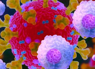 Patients with severe COVID-19 have a different composition of responding NK cells