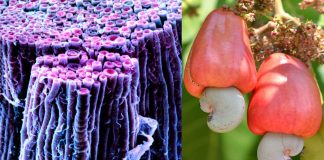 Il guscio dell’anacardio favorisce la riparazione della mielina