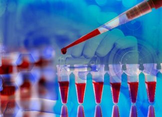 COVID-19: New blood-based test uses a gene expression assay to correctly predict nine different respiratory viral infections – including influenza, enterovirus, adenovirus and coronaviruses