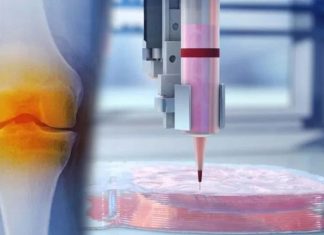 Cartilage regeneration : researchers developed a new 3-D bioprinting