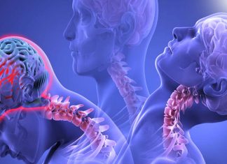 Even mild concussions cause severe and long-lasting impairments in the brain’s ability to clean itself of toxins