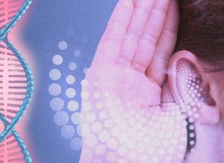 Hearing loss has been shown to be linked to dementia in epidemiological studies