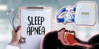 Obstructive sleep apnea (OSA): new version of palate surgery
