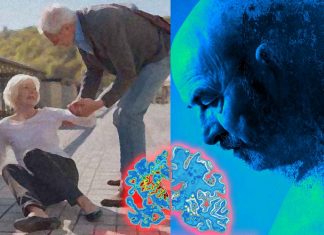Older people who have experienced falls should be screened for Alzheimer’s