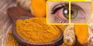 Uveite: i ricercatori sviluppano un trattamento alla curcuma