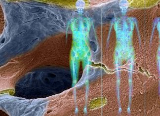 Researchers found associations between lower bone mineral density and worse cardiovascular health