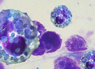 Why are females at increased risk for common diseases that involve or target the immune system ?