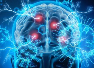 COVID-19 can cause epilepsy in patients. How does it work ?