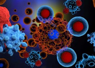 Neoadjuvant immunotherapy using a combination of nivolumab and ipilimumab is effective in treating locally invasive bladder cancer