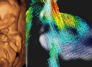 New 4-D MRI imaging in utero helping detect congenital heart disease of a baby in pregnant mothers