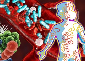 SeptiCyte RAPID : Sepsis detection technology that can triage COVID-19 patients