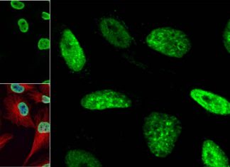 COVID-19: Researchers identified dozens of genes that enable/block the viruses to replicate in cells